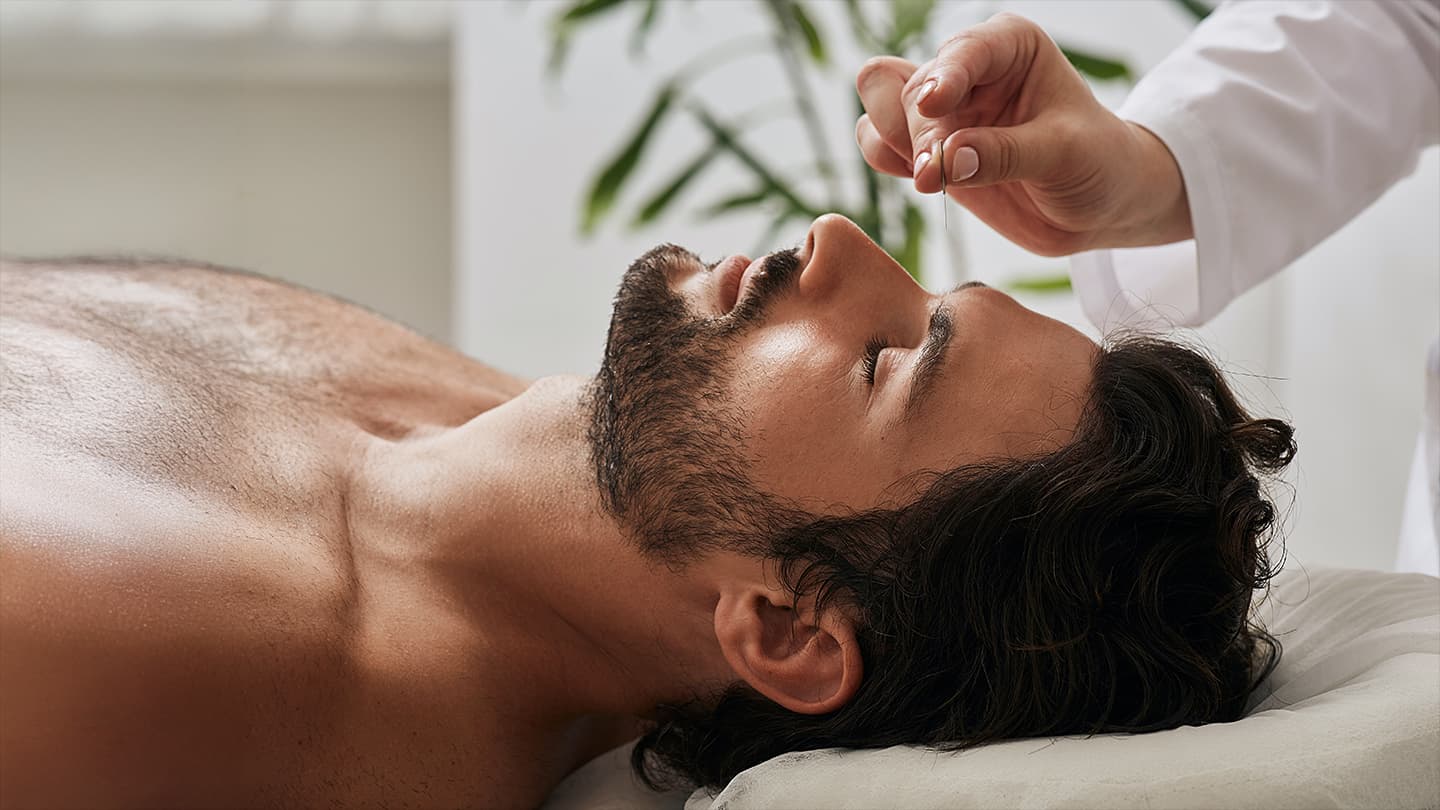 Explore Acupuncture Therapy and See If It Fits Your Life