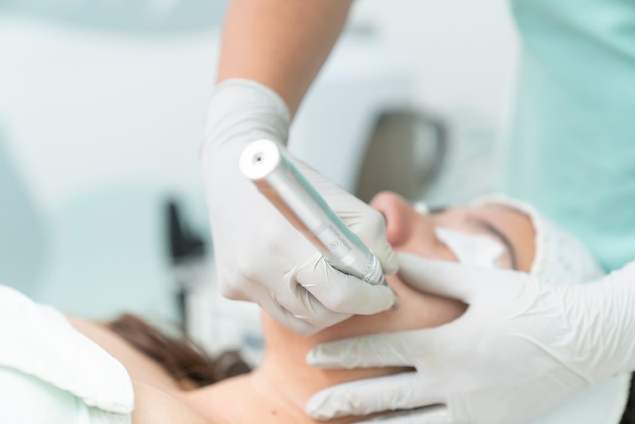 Dental Professional Using Treatment Device Dental professional in white gloves holding a handheld treatment device during a patient procedure.