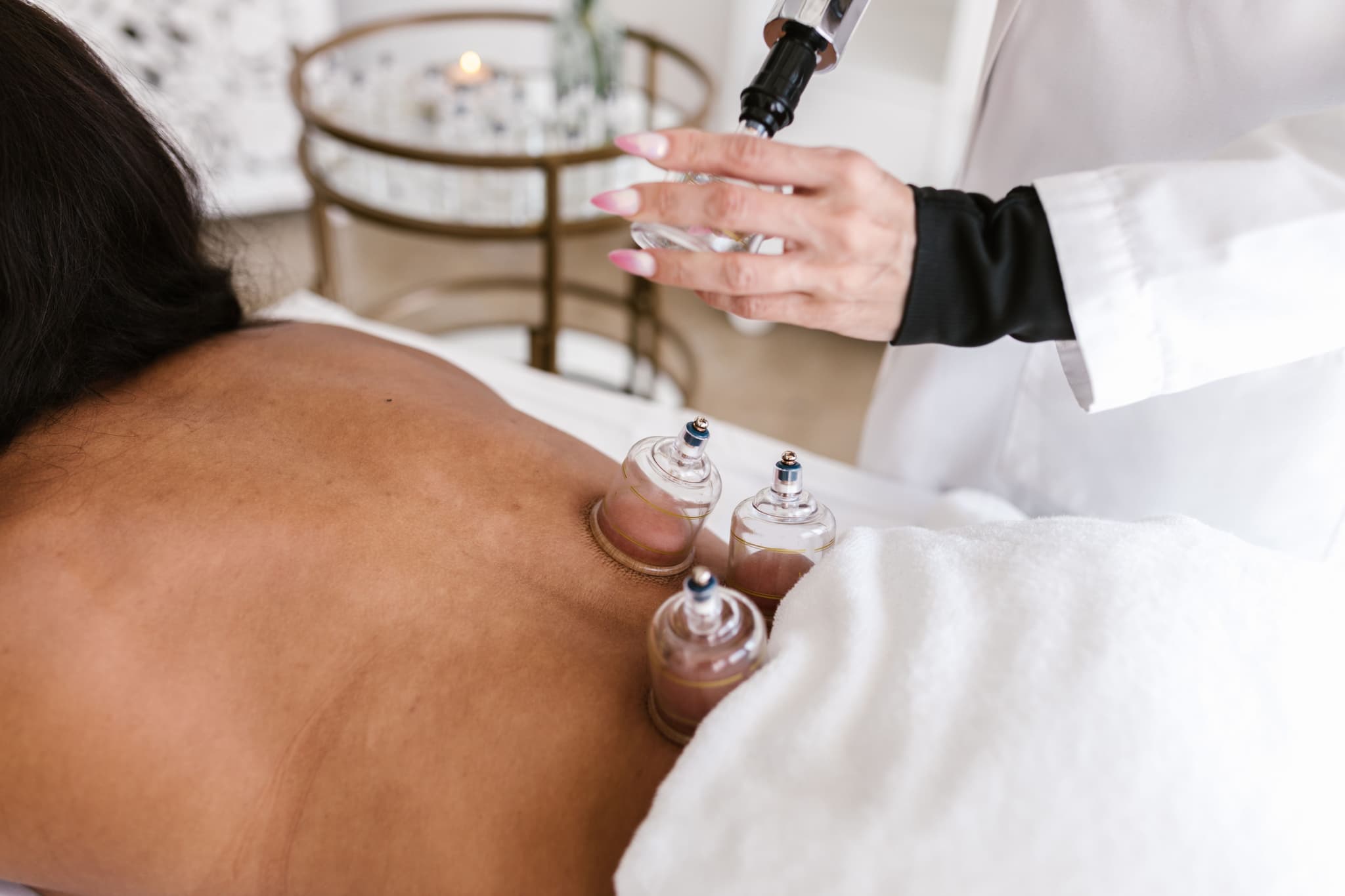 Cupping Therapy Spa Treatment A therapist applies cupping therapy to a client's back during a spa treatment session.